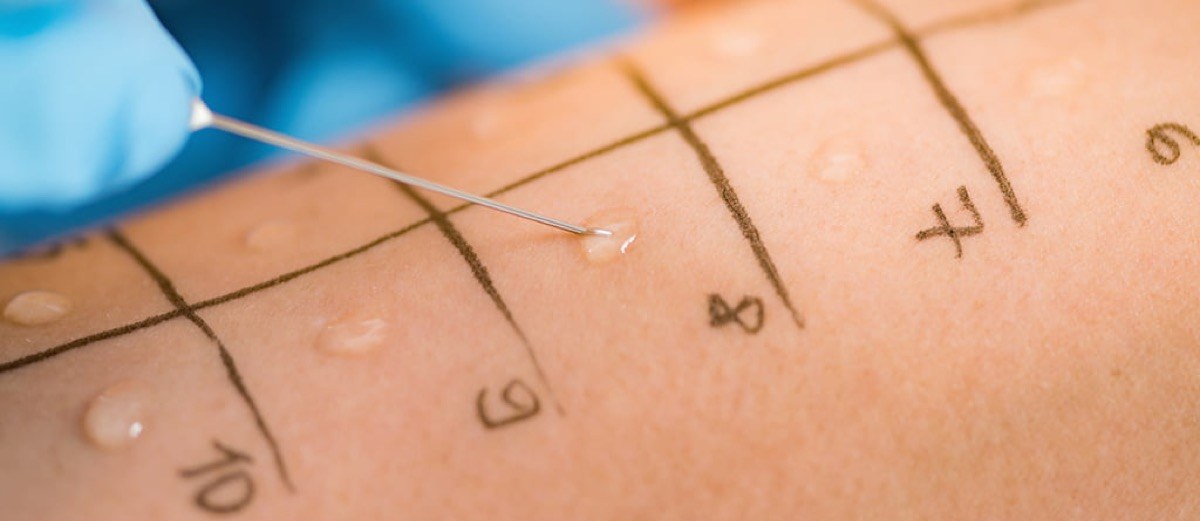 Allergy Care at NYC Medical Doctor PC
